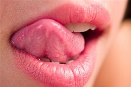 Lưỡi bị rát và nổi mụn là bệnh gì?